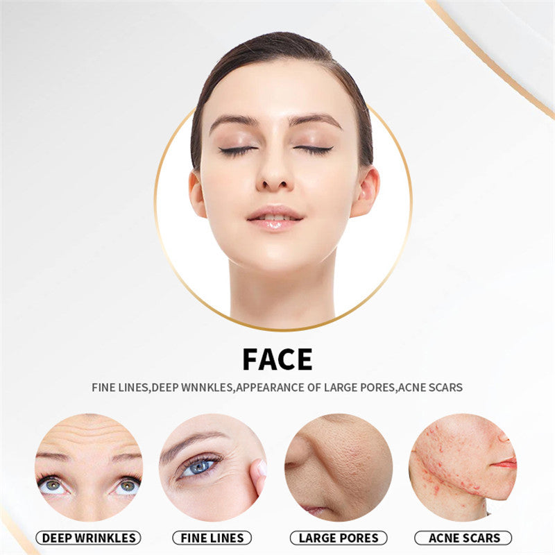 Microneedle RF Fractional Machine Facial Anti Wrinkle Lifting Scars Stretch Marks Removal Collagen Remodeling