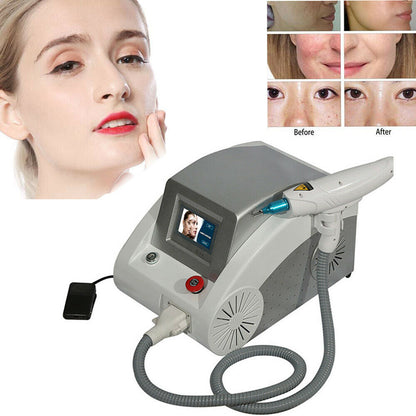 ND YAG Laser Tattoo Removal Pigmentation Treament Carbon Peeling Beauty Q-switch Machine