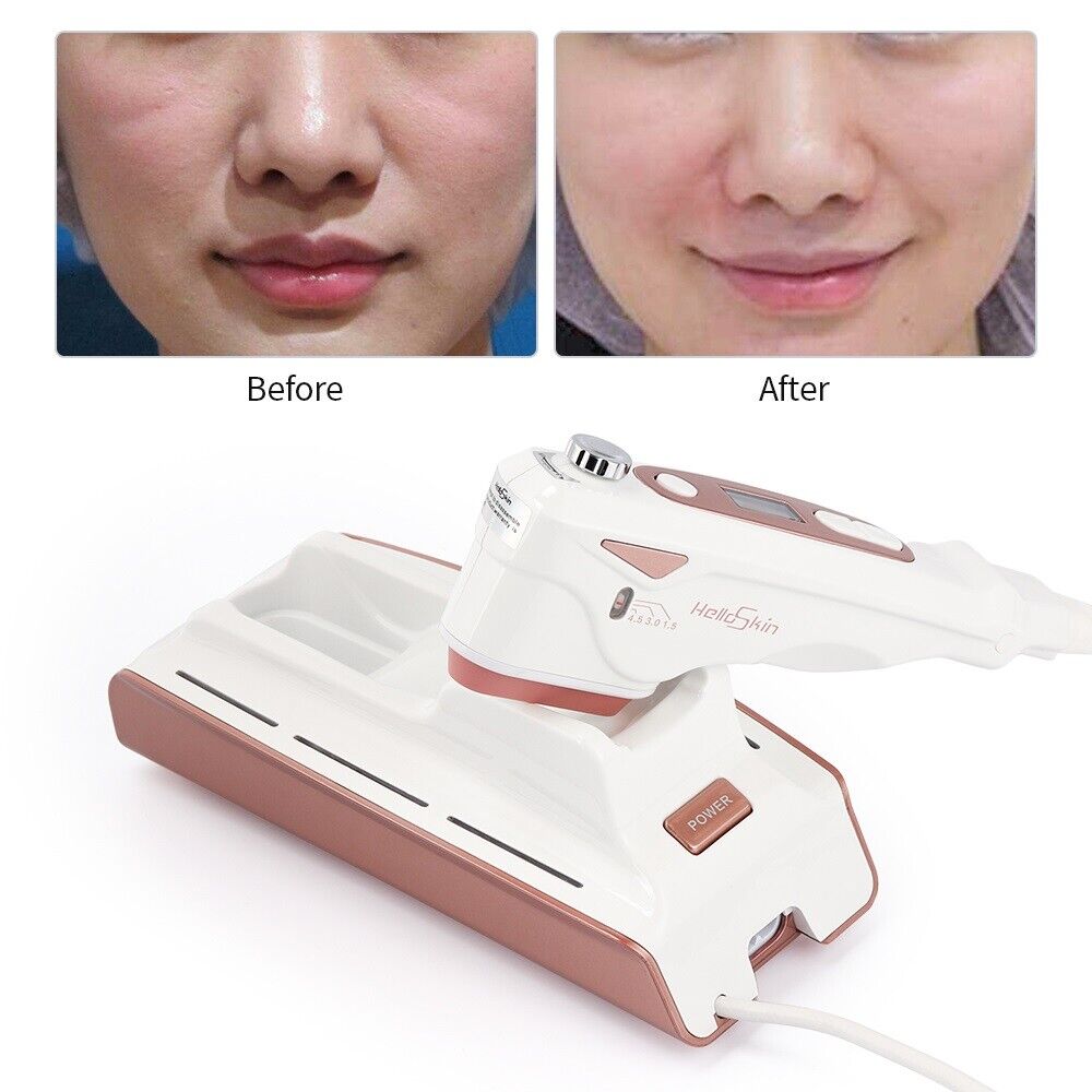 Handheld Ultrasonic HIFU Skin Machine Radio Rejuvenation Face Lifting Anti-aging