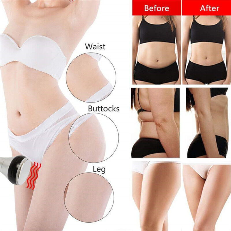 6IN1 40K Cavitation Lipo Laser Facial RF Loss Weight Body Slimming Skin Lifting Machine