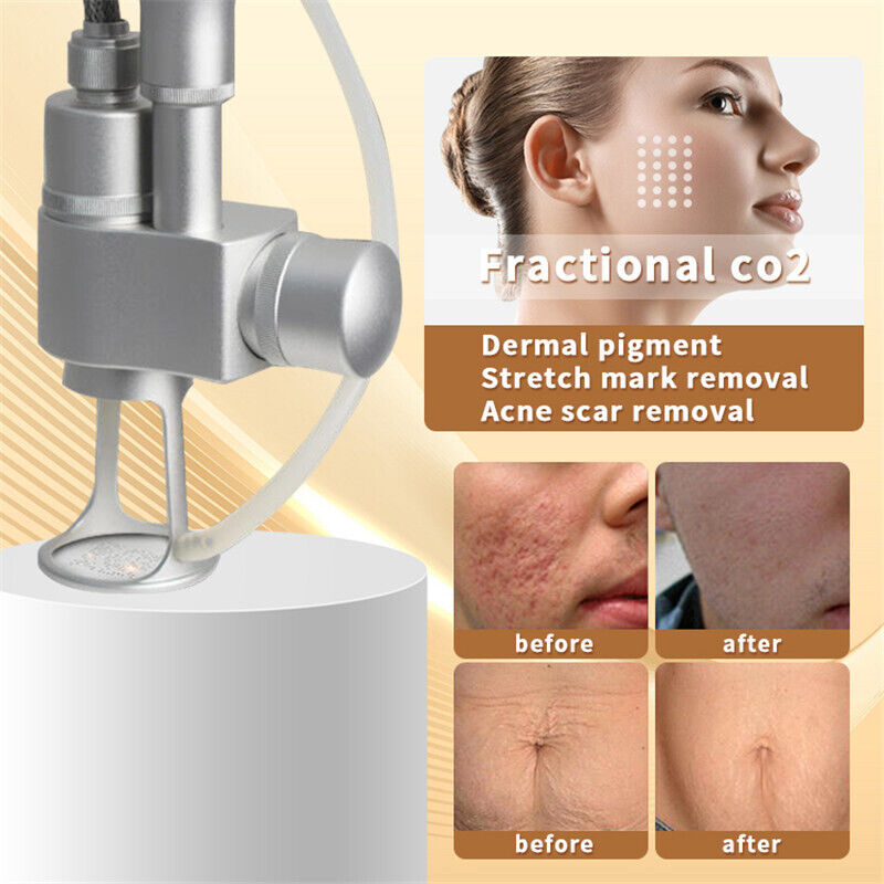 CO2 Fractional Laser Machine Skin Rejuvenation Acne Treatment Fractional co2 Laser For Stretch Marks Scar Removal Device