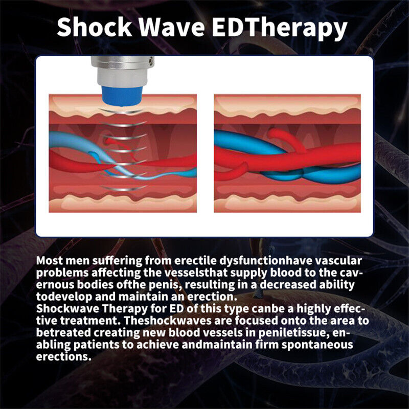 ED Shockwave Therapy Machine Pain Removal Erectile Dysfunction Treatment Relax