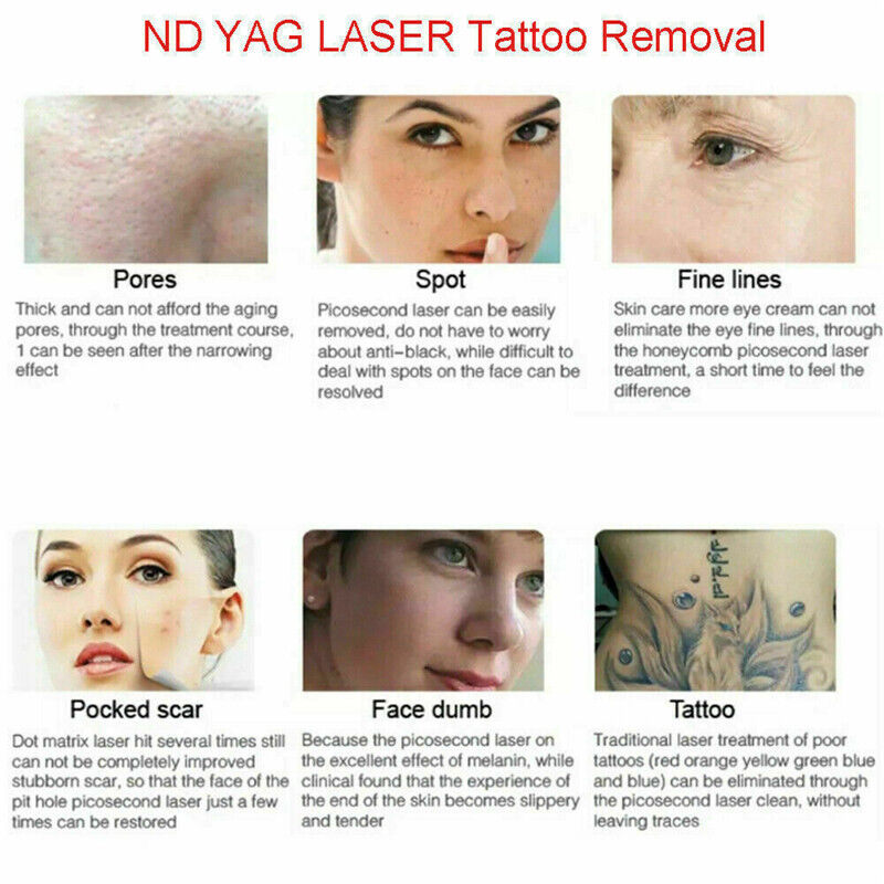 808nm Diode Laser Hair Removal Picosecond Tattoo Removal Skin Care Machine Women