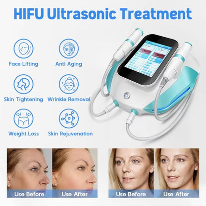 2in1 Ultra Hifu Facial Lifting Winkle Removal Machine Vmax RF Anti Aging Body Shaping