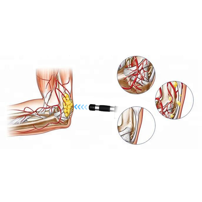 Pneumatic ED Shockwave Therapy Machine 10 Bar Radial Shock wave Pain Relief Body Massager