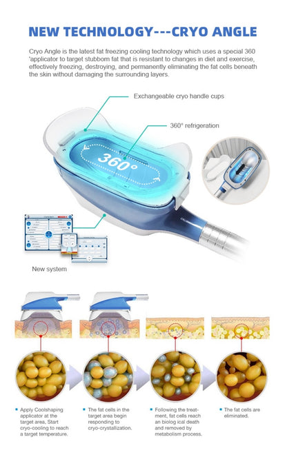 Cryolipolisis Weight Loss Cavitation RF 360° Cryolipolysis Fat Freeze Machine