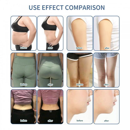 Body Sculpting Cryolipolysis Fat Freezing Fat Reduce Machine Slimming Shaping