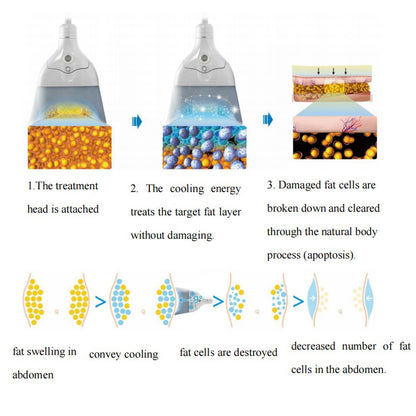 Body Sculpting Cryolipolysis Fat Freezing Fat Reduce Machine Slimming Shaping