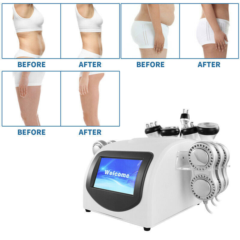 Cavitation Body Slimming Machine Vacuum Radio Frequency Skin Care Fat Removal