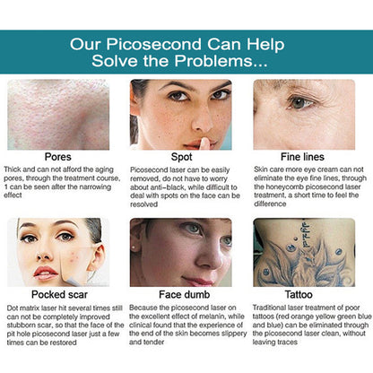 Picosecond Laser Tattoo Removal Machine Pico Laser For Skin Rejuvenation Pigment